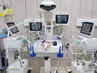 曼德勒一名23岁产妇生下双胞胎男婴，但新生儿的胸部“骨肉相连”