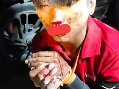 缅甸曼德勒瀑布山附近路段，有一名男子惨遭割喉